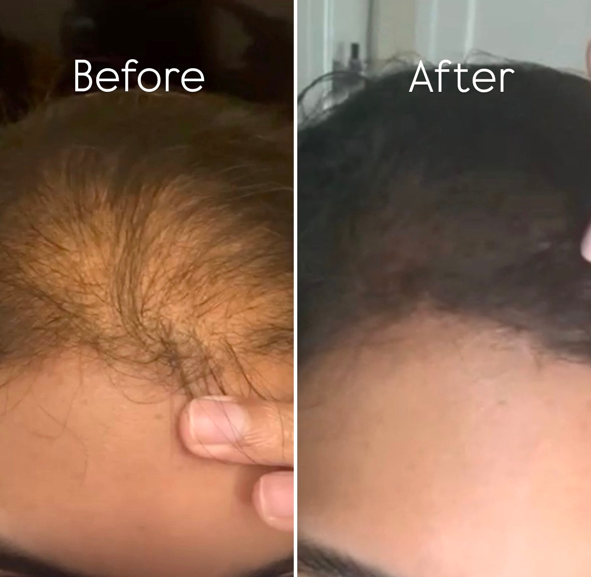 Root Food- SPRAYABLE Hair Growth Oil